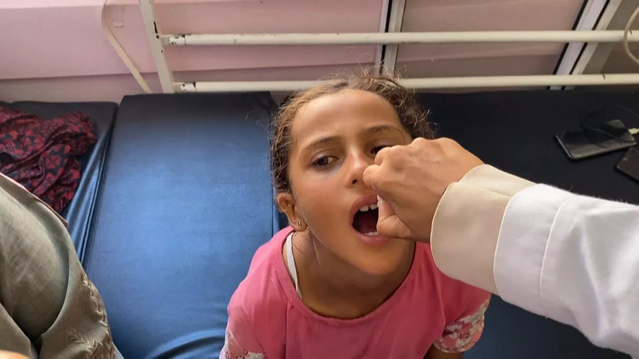20240901112026_polio_