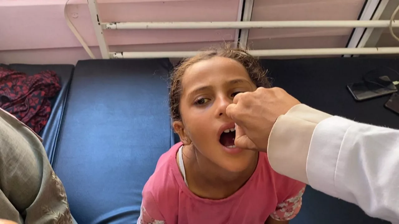20240901112545_polio_