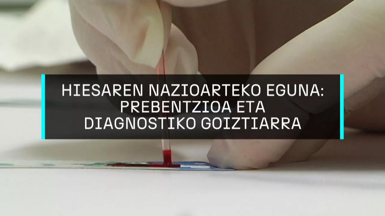 20241130103540_hiesa_