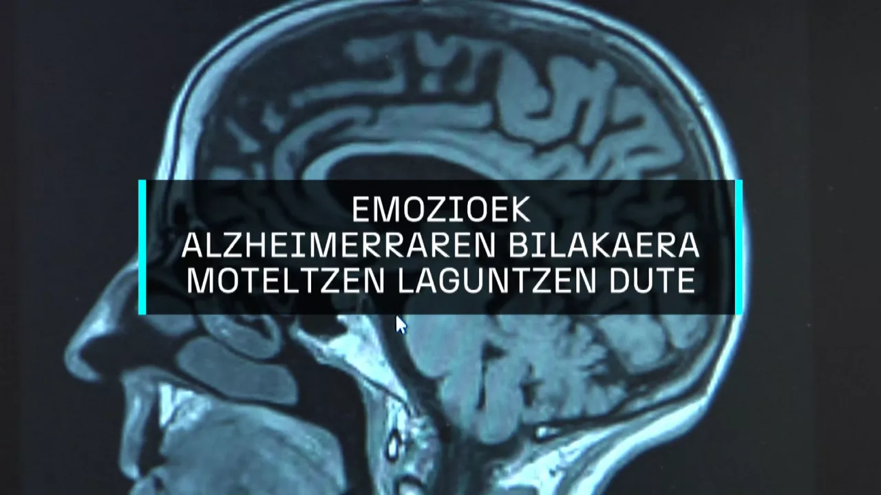 20250125174630_alzheimer_