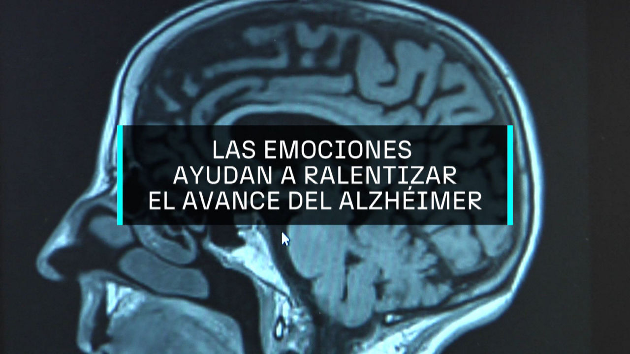 20250125180258_alzheimer_