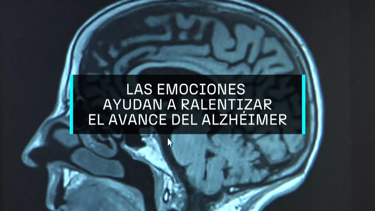 20250125180258_alzheimer_
