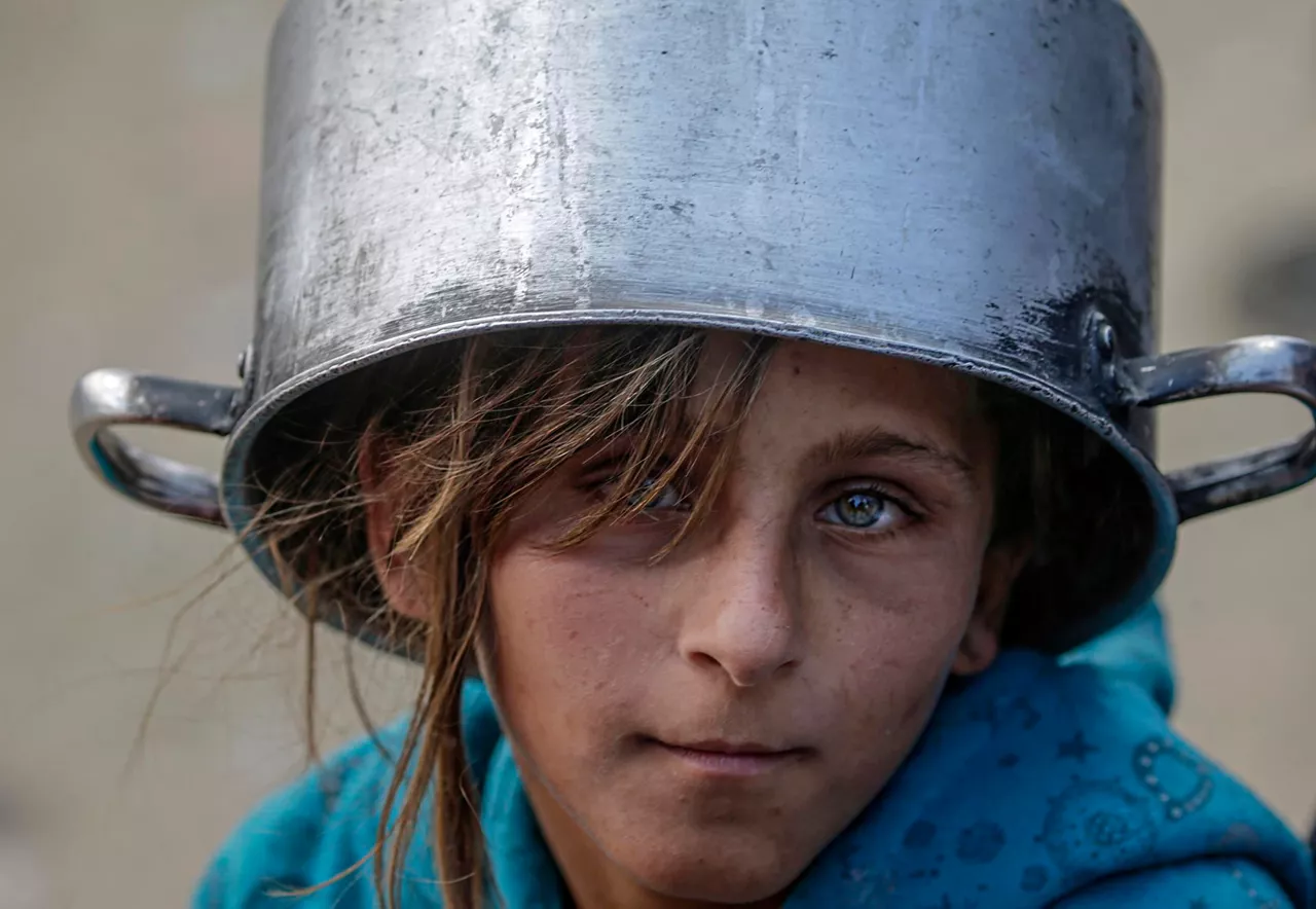 hambre-Gaza-efe