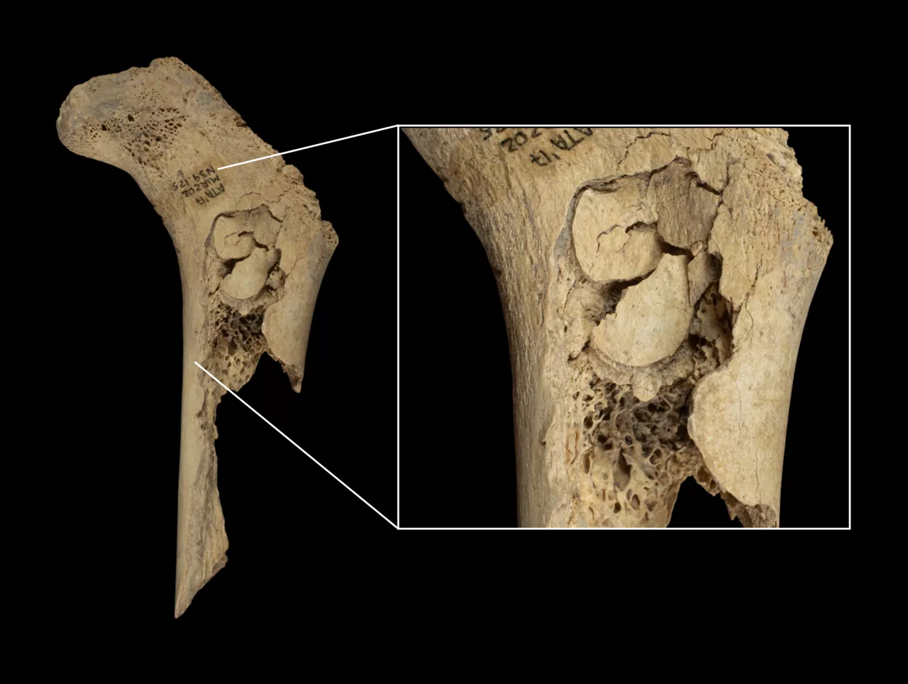 Un equipo multidisciplinar de investigadores ha descrito un nuevo episodio de canibalismo en el Yacimiento de Atapuerca (Burgos), un evento ocurrido hace unos 5.700 años -en el Neolítico final- debido probablemente a conflictos locales entre grupos pero sin que se hayan detectado indicios relacionados con ceremonias o rituales. Es la principal conclusión de un estudio, publicado hoy en la revista Scientific Reports, que ha permitido documentar un episodio de violencia entre grupos ganaderos del neolítico que derivó en un caso de canibalismo. Los restos encontrados en la cueva de El Mirador corresponden al menos a once individuos, incluidos niños, adolescentes y adultos que fueron despellejados, descarnados, desarticulados, fracturados, cocinados y finalmente consumidos, según las evidencias que los investigadores han hallado en los huesos, ha informado el Instituto Catalán de Paleoecologia Humana y Evolución Social (IPHES), que ha coordinado los estudios junto al Instituto de Arqueología de Mérida.-EFE/Instituto Catalán de Paleoecologia Humana y Evolución Social (IPHES)

