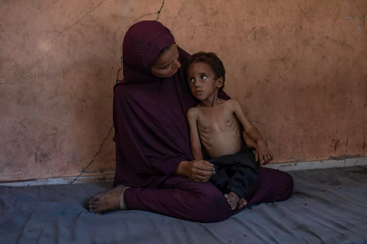 GAZA (---), 19/07/2025.- Palestinian child Yazan Abu Foul, aged two, is cared for by his mother Naima, as he suffers from severe malnutrition due to the acute shortage of food caused by the blockade imposed on the Gaza Strip and the closure of border crossings, in Al-Shati refugee camp, west of Gaza City, 19 July 2025. Yazan lives in harsh environmental and health conditions, with his family lacking the basic necessities of life amid a worsening humanitarian crisis. According to medical sources, the child’s health continues to deteriorate due to the lack of proper nutrition and necessary medical care. Humanitarian organizations have warned of an imminent food catastrophe threatening the lives of thousands of children in the besieged Gaza Strip, this situation coming at a time when Gaza’s residents face severe food insecurity and a sharp decline in health services, amid ongoing restrictions on the entry of humanitarian aid and essential supplies. EFE/EPA/HAITHAM IMAD

