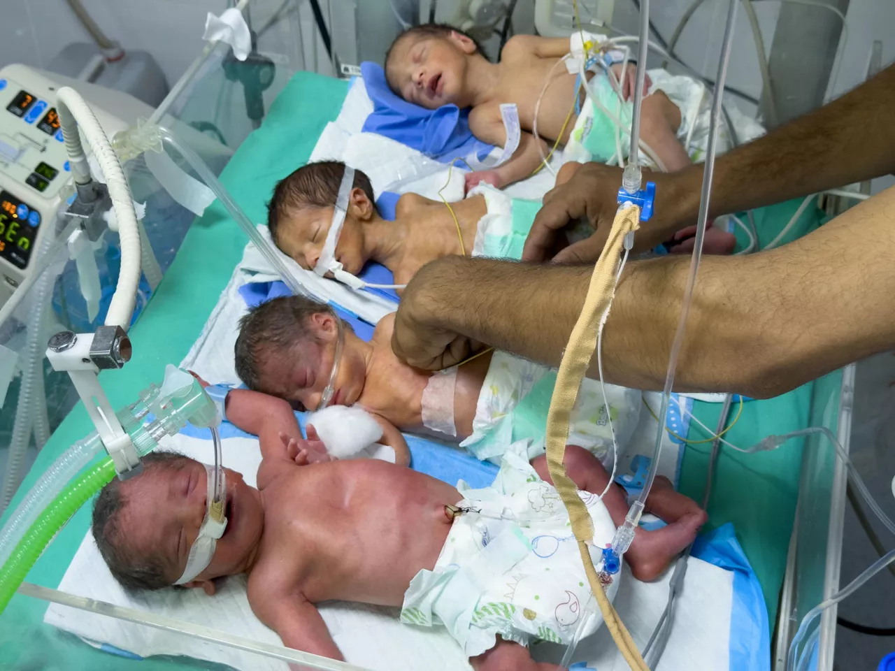 CIUDAD DE GAZA (PALESTINA), 17/07/2025.- Fotografía del 17 de julio que muestra a cuatro niños nacidos prematuros y con signos de malnutrición, en una sola incubadora, debido a que el hospital Al Helou no cuenta con suficientes y el número de niños nacidos prematuros ha incrementado por la dificil situación que afrontan las madres. El azote de la ofensiva israelí en Gaza ha sacudido todos y cada uno de los cimientos del enclave. Israel ha arrasado ciudades y familias enteras, colegios y universidades, mezquitas y hospitales. Ahora, tras casi cinco meses de cerco, son muchos los bebés gazatíes que nacen prematuros y desnutridos, enfrentándose a una muerte que debería ser evitable.EFE/ Ahmad Awad
