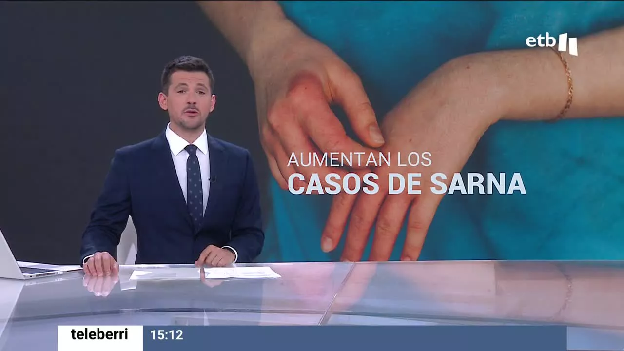 El Departamento de Salud ha tenido que reforzar el protocolo contra la sarna tras registrarse un aumento significativo de casos, sobre todo en Bizkaia. Los expertos no saben a qué se debe el incremento.