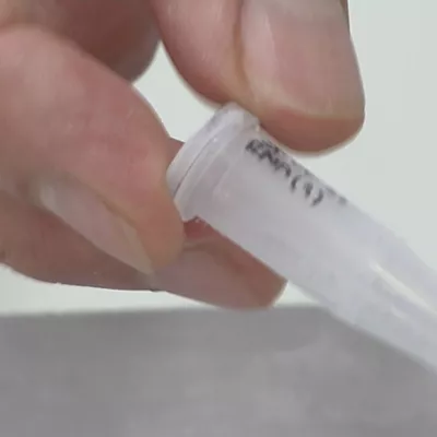 analisis saliva listua ikerketa ehu