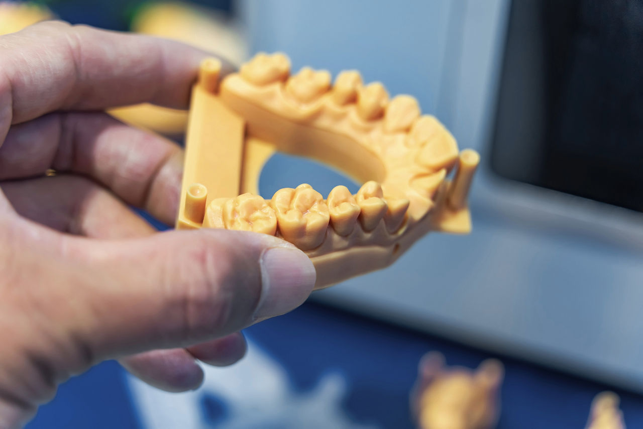 Dental technician modeling frame for implant production from a 3d printer at the laboratory