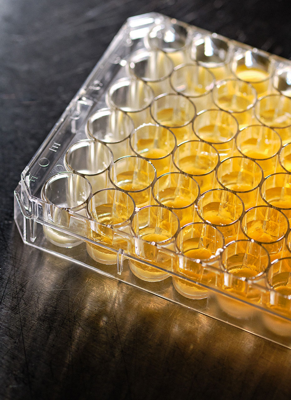 A yellow liquid in around 30 small test tubes. At the bottom is sebum, an icy layer of fat.