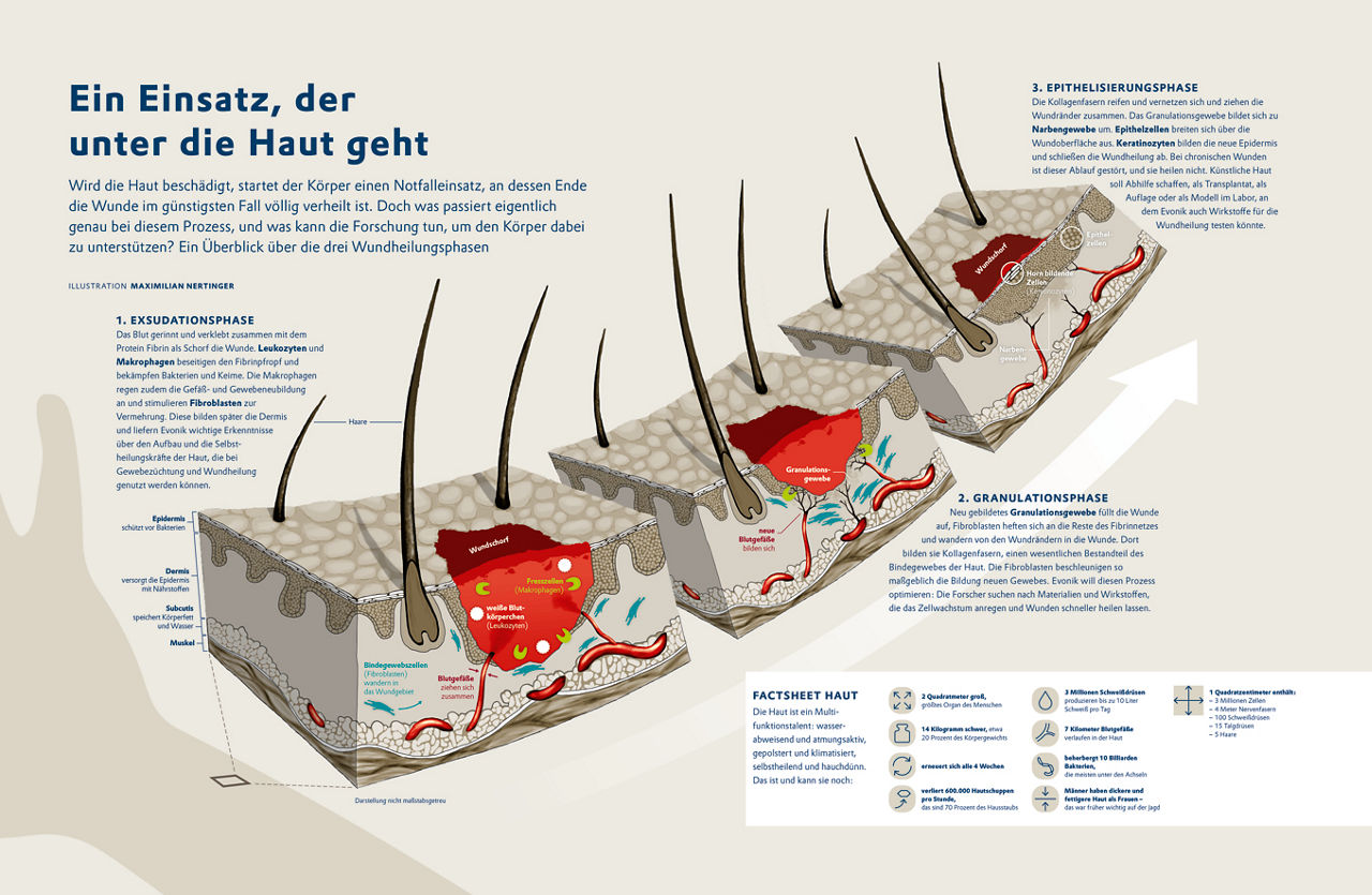 Infografik Wundheilung