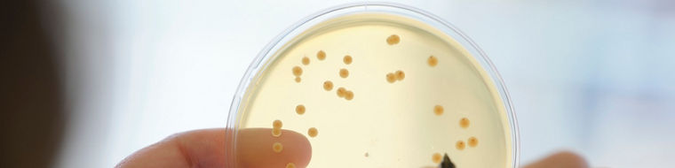 In an agar plate at the Evonik laboratory in Halle-Künsebeck, bacterial colonies are counted. Under favorable conditions and warmth, each spore in the sample grows into a visible colony containing several million bacteria.