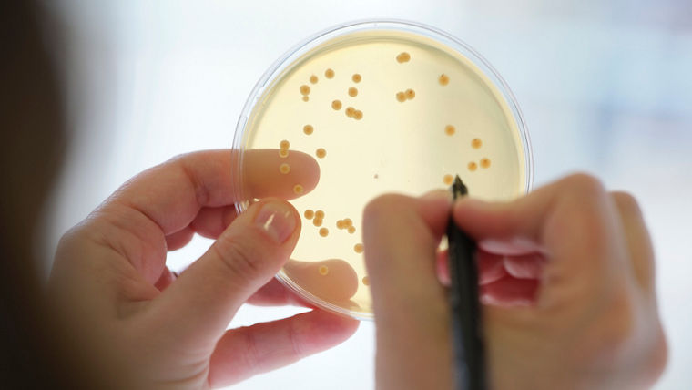 In an agar plate at the Evonik laboratory in Halle-Künsebeck, bacterial colonies are counted. Under favorable conditions and warmth, each spore in the sample grows into a visible colony containing several million bacteria.