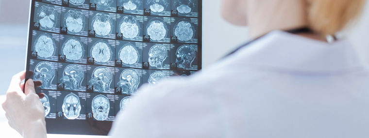 Providing radiograph before operation. Proficient experienced female neurosurgeon working at the x ray laboratory while examining brain radiograph and analyzing patient health