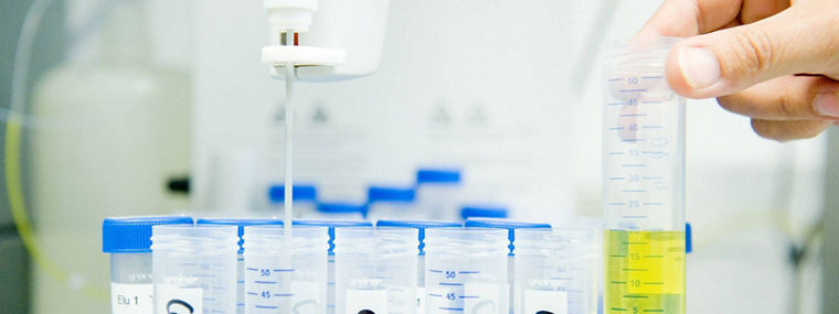 The image depicts a laboratory setting where a person is conducting an experiment involving the measurement of liquid samples. In the foreground, a hand is holding a graduated cylinder filled with a yellow liquid, which is being compared to a row of clear test tubes placed in a rack. Each test tube has a blue lid and is labeled with handwritten identifiers, suggesting they contain different samples or concentrations. A pipette is positioned above one of the test tubes, indicating that a precise amount of liquid is being dispensed. The background features additional laboratory equipment, contributing to the scientific atmosphere of the scene.