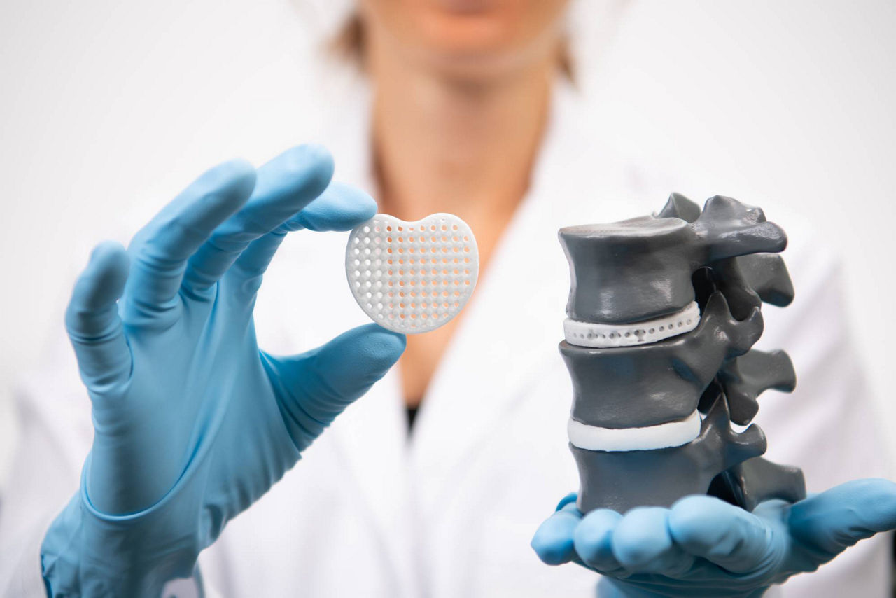 Resomer Wirbelsäulenimplantat