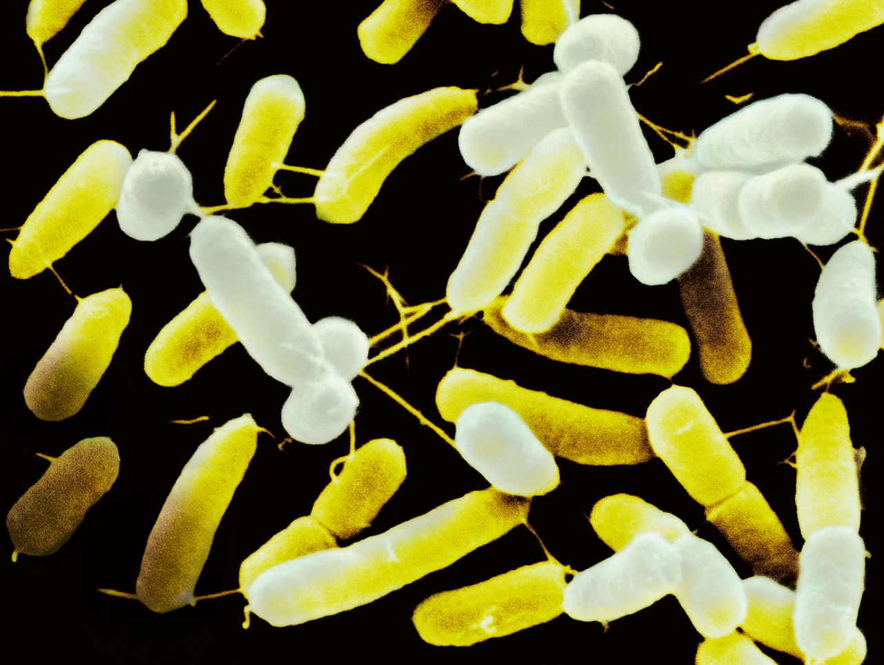 Gelblich erscheindende Bakterien im Bild eines Mikroskops.