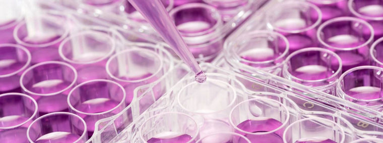 Lab pipette dispensing purple liquid into well plates—symbolizing Evonik’s specialty amines for industrial and consumer chemical applications.