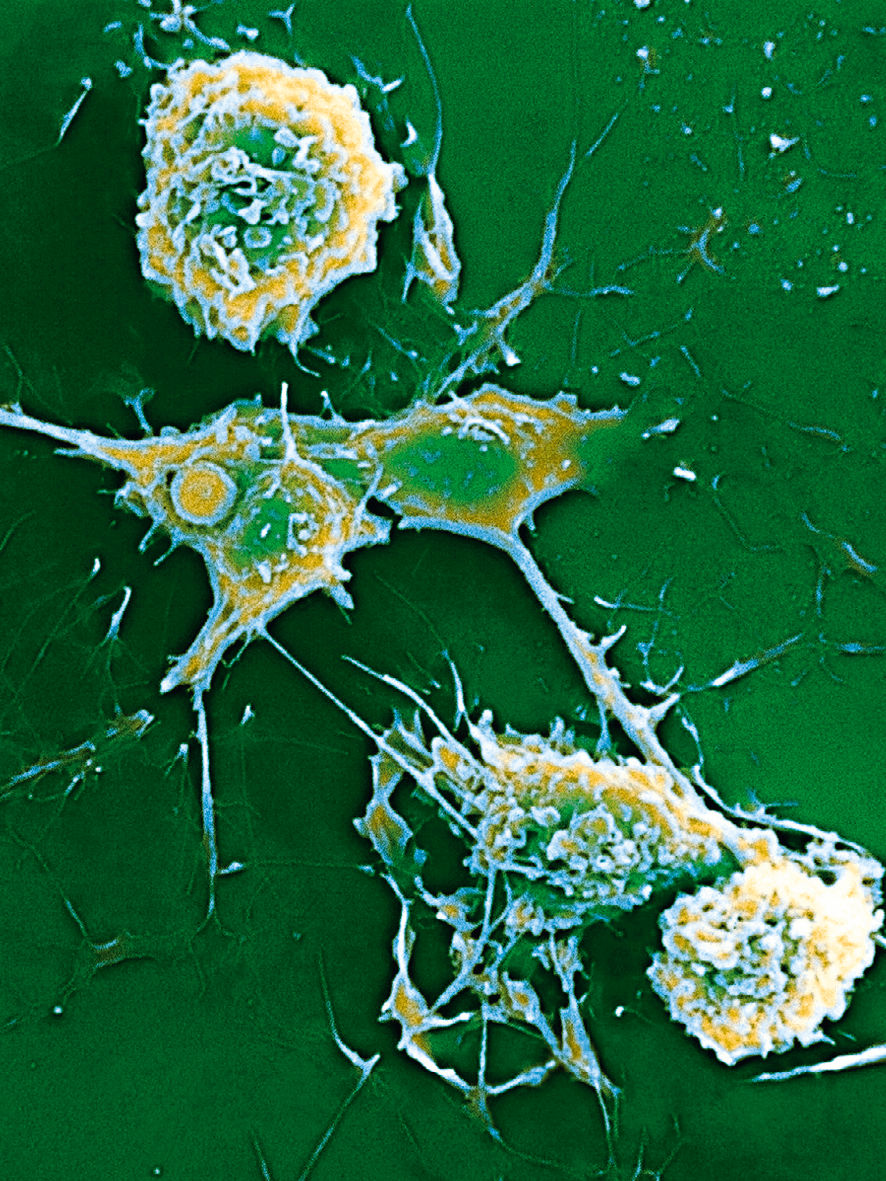 MS-Erreger auf einer Mikroskop-Aufnahme.