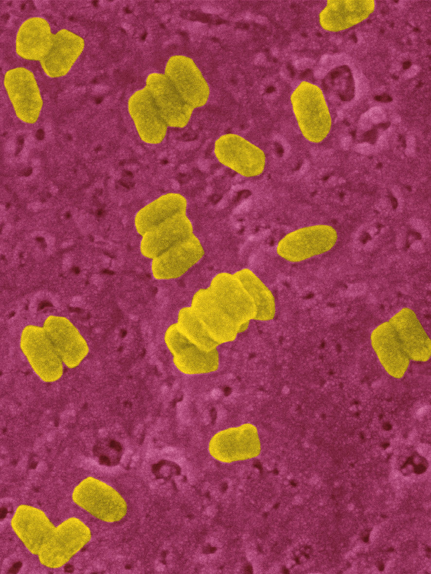 Mikroskopaufnahme eines Tollwuterregers
