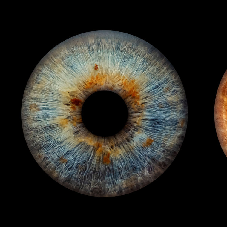 Two different irises.