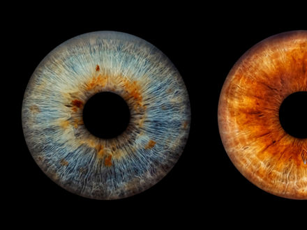 Two different irises.