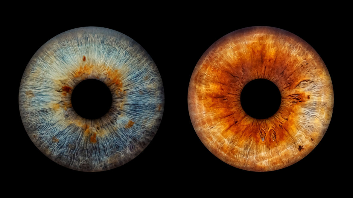 Two different irises.