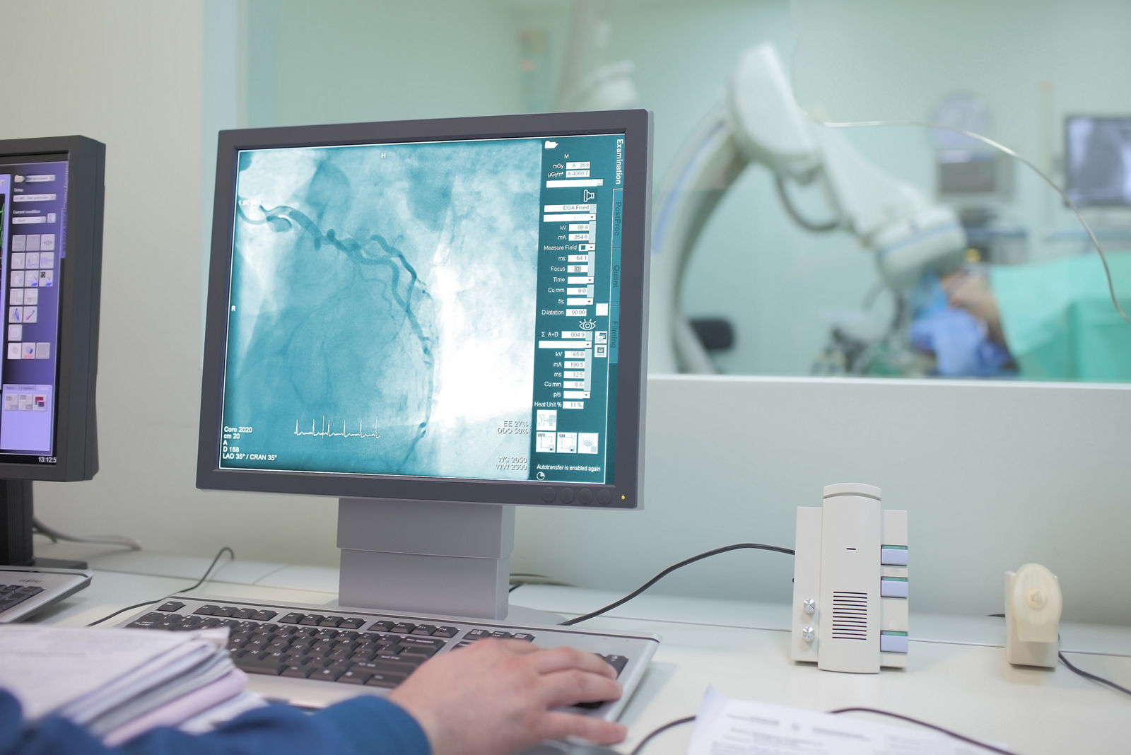 Angiographie: Was bei der Untersuchung passiert und wann sie eingesetzt wird