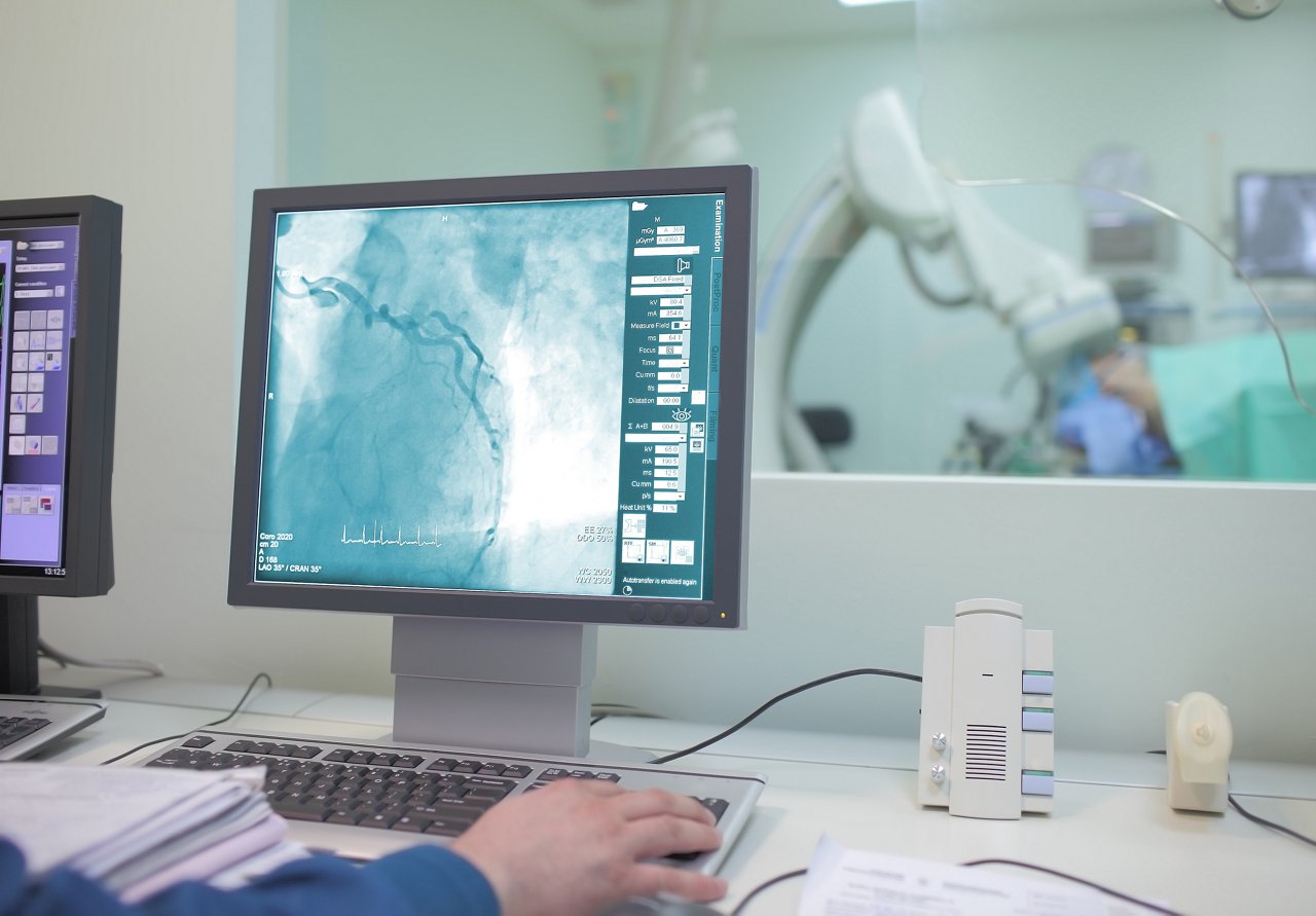 Visualization of the heart vessels (coronary vessels) on the monitor in the operating x-ray lab.