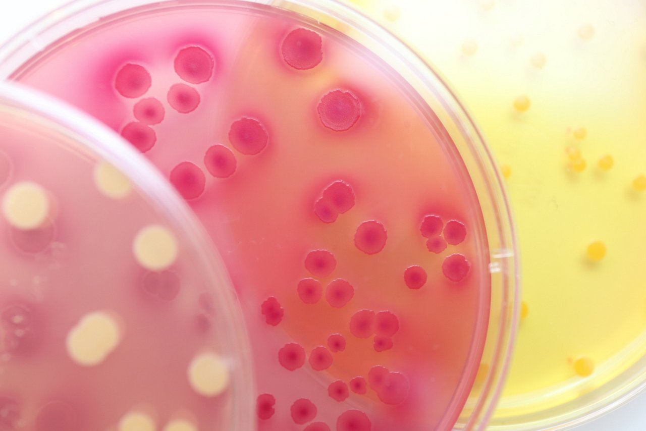 Drei bunt leuchtende Petrischalen mit keimendem Probenmaterial