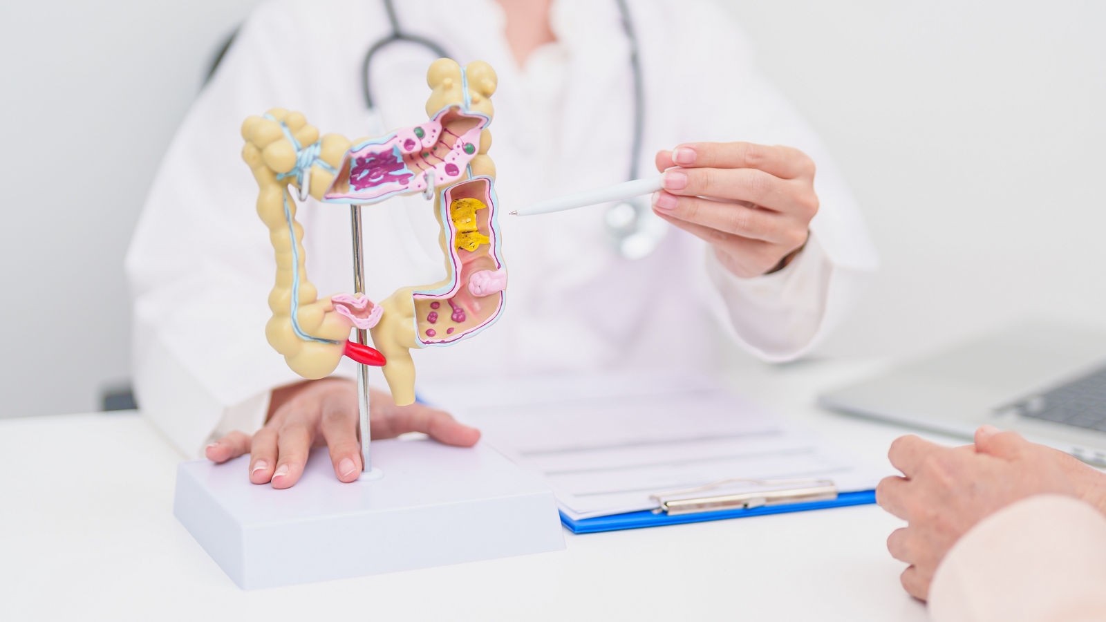 Ärztin zeigt Patientin etwas an einem Darmmodell