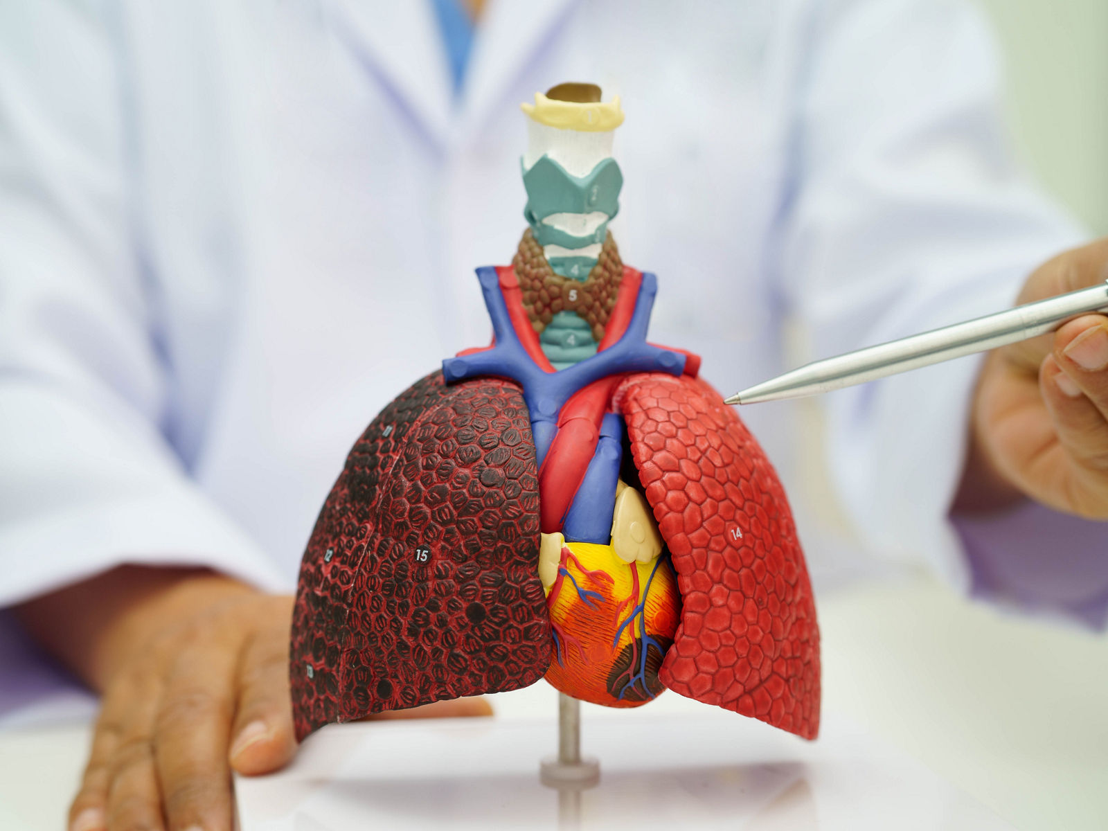Lungenentzündung, Lungenkrebs:  Arzt hält ein Modell der menschlichen Anatomie für Studium, Diagnose und Behandlung im Krankenhaus.
