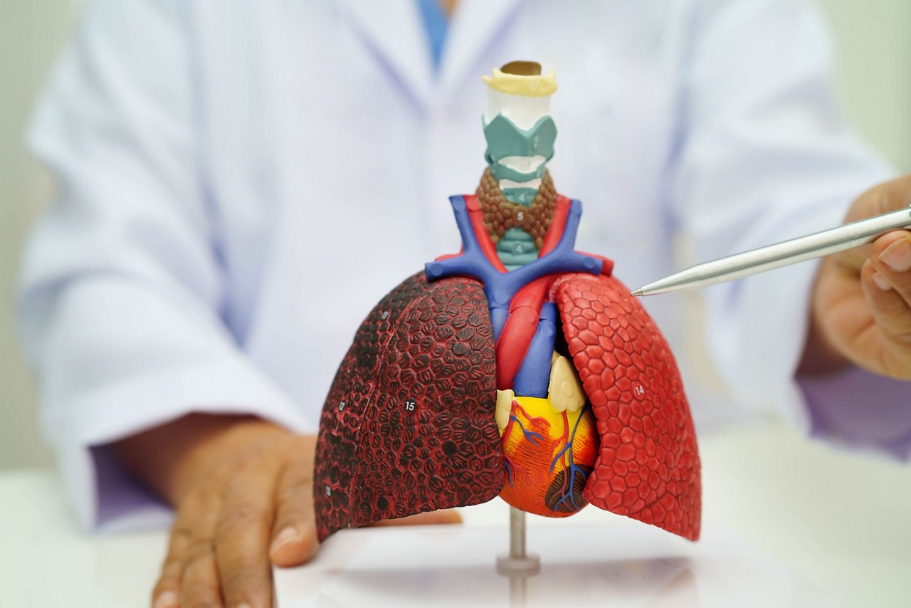 Lungenentzündung, Lungenkrebs:  Arzt hält ein Modell der menschlichen Anatomie für Studium, Diagnose und Behandlung im Krankenhaus.