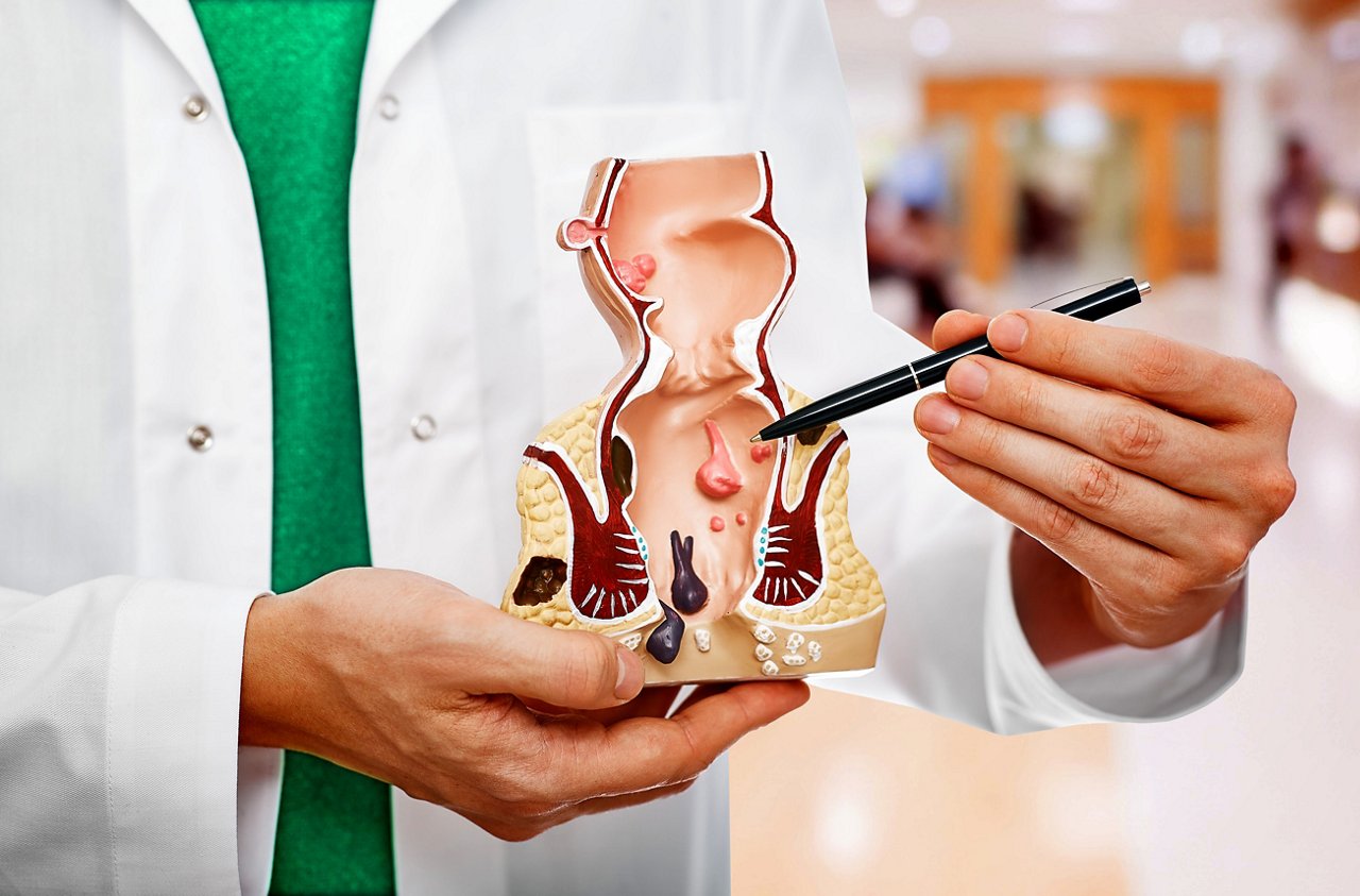 Arzt demonstriert die menschliche anorektale Anatomie anhand eines Modells in einer medizinischen Umgebung.
