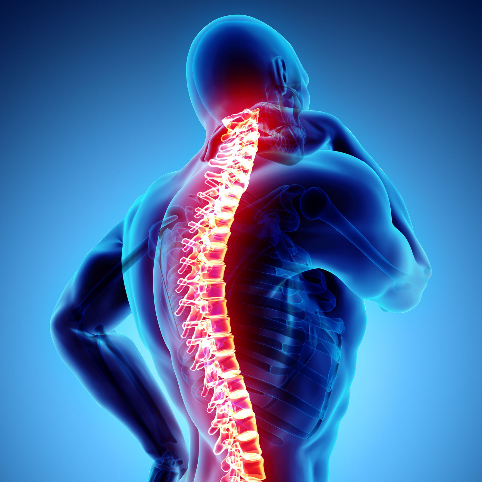 3D Illustration of sacral and cervical painful, medical concept.