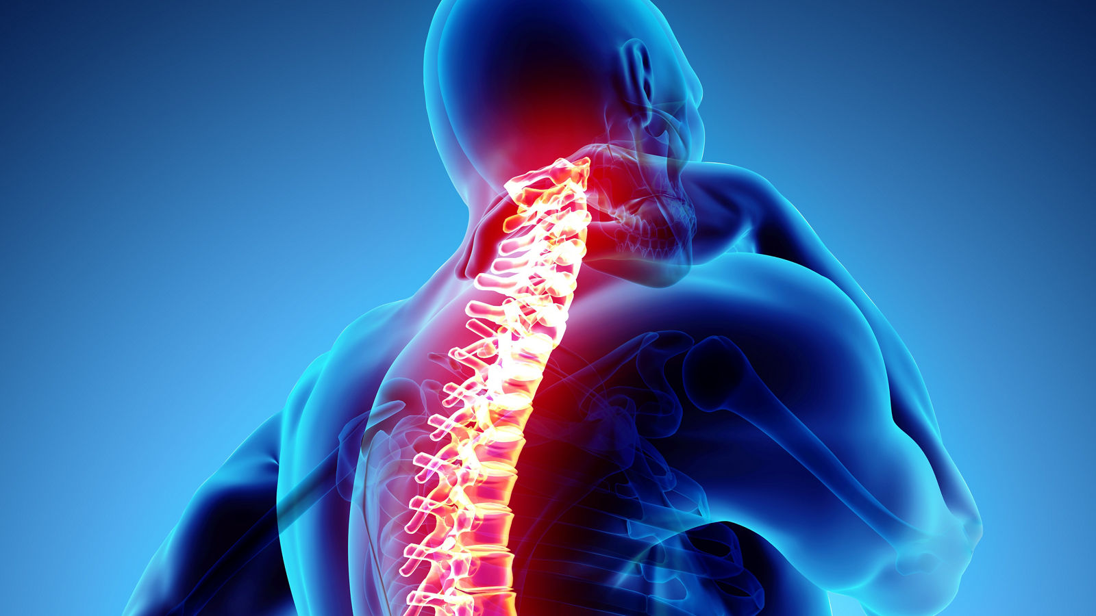 3D Illustration of sacral and cervical painful.