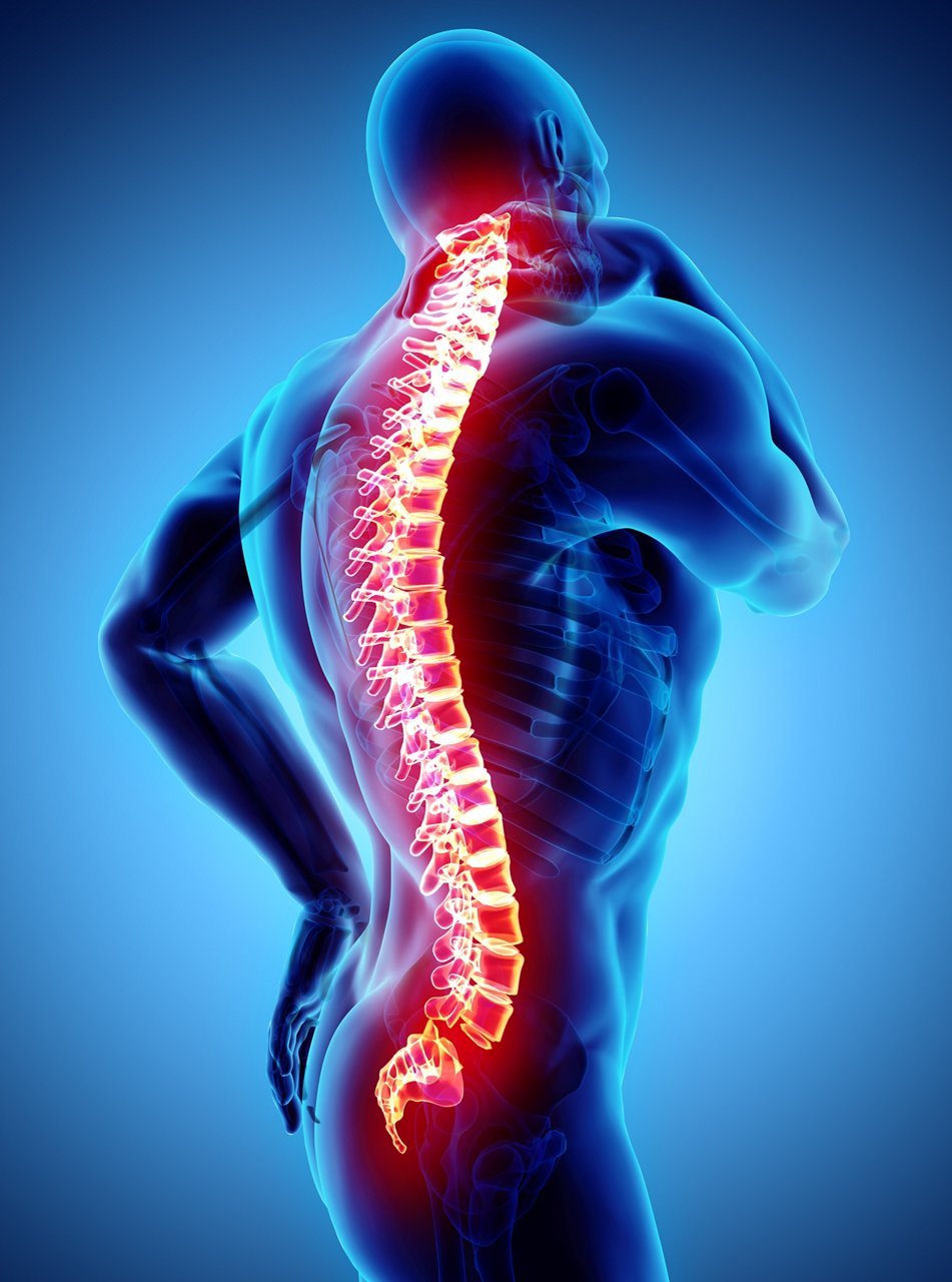 3D Illustration of sacral and cervical painful, medical concept.