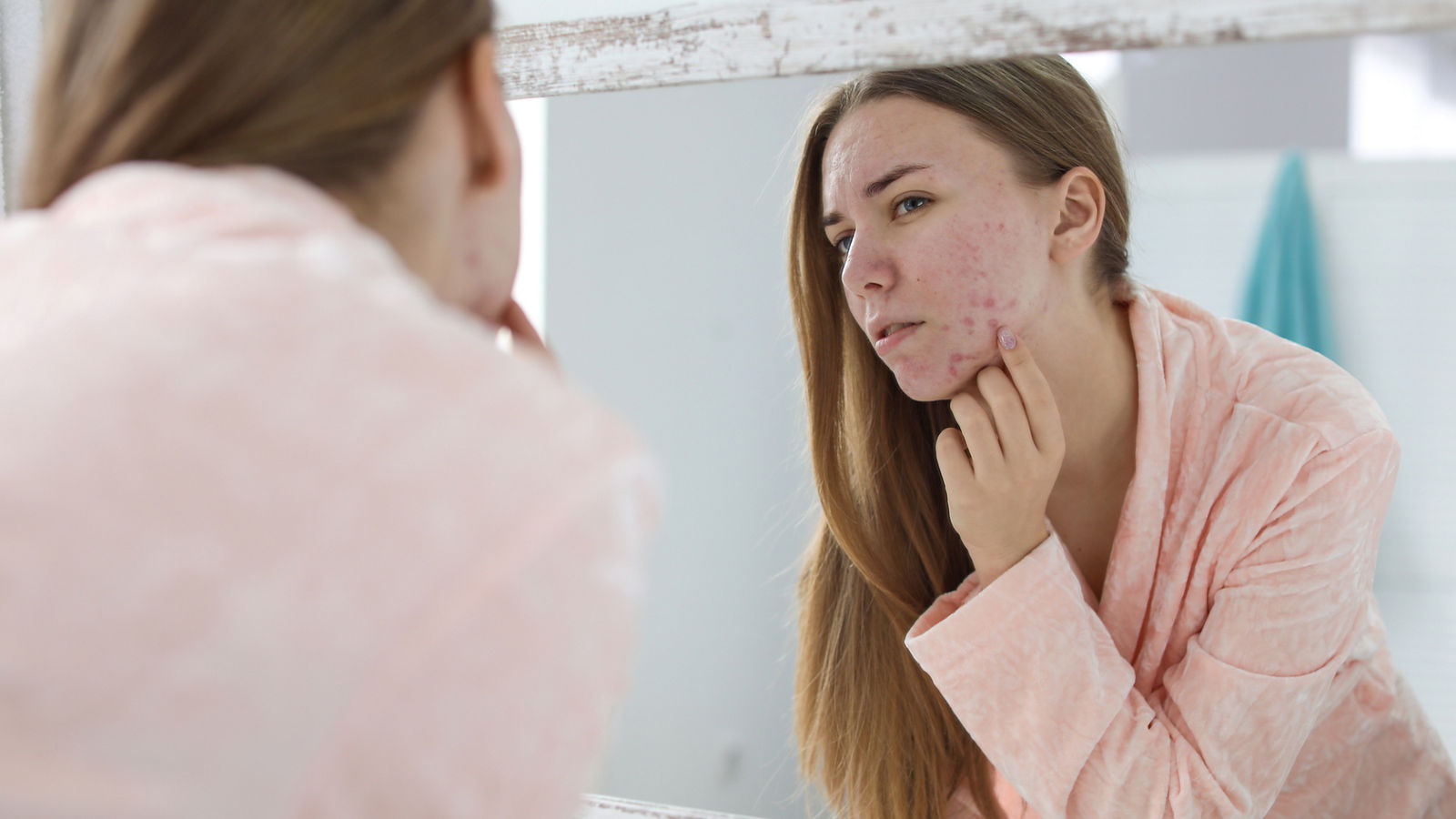 Young woman with acne problem near mirror in bathroom