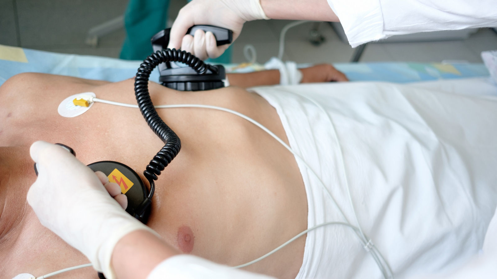 hands of doctor holding defibrillator electrods, performing defibrillation or electropulse therapy