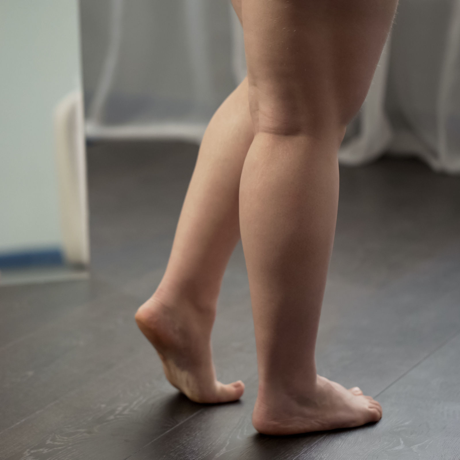 Obese ladys feet, unhealthy woman suffering excess weight and varicose veins
