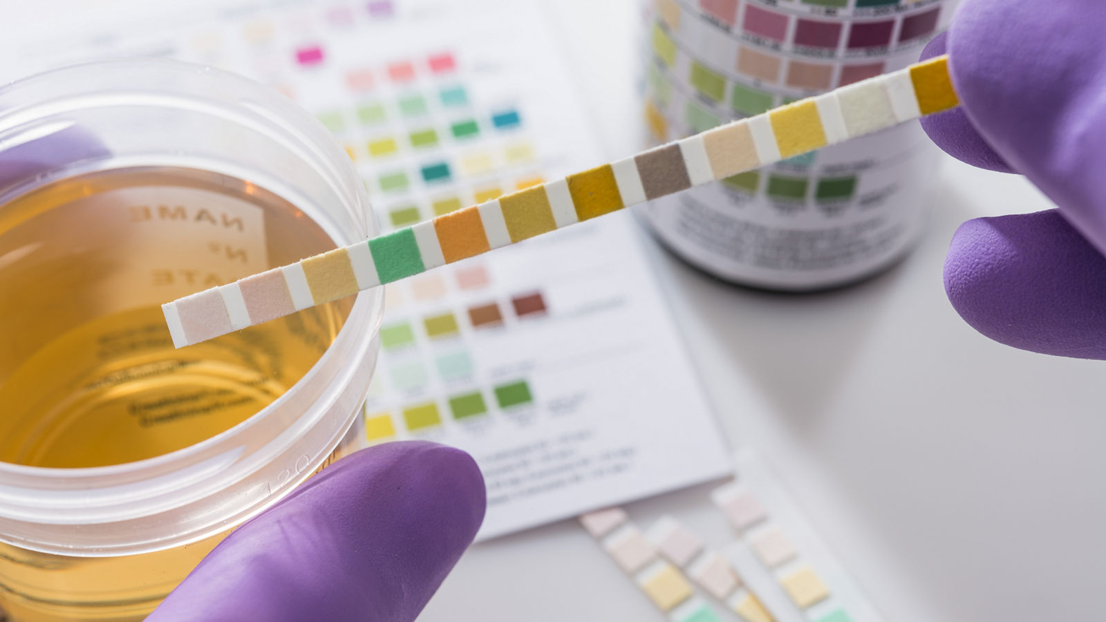 urine test strips in purple gloves