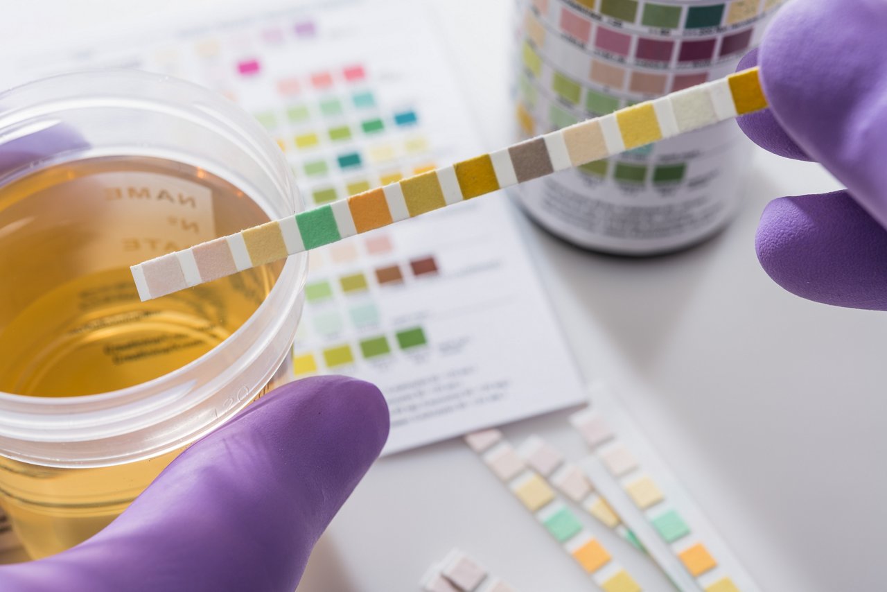 Test tires in violet gloves with test chart and urine can