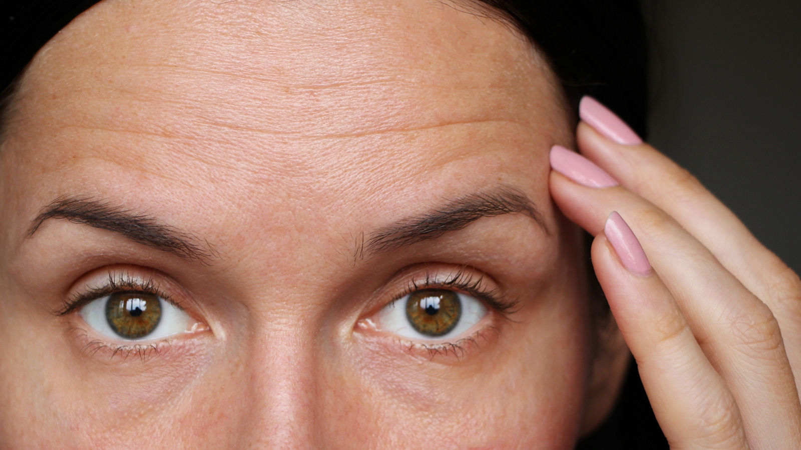 wrinkles on the forehead