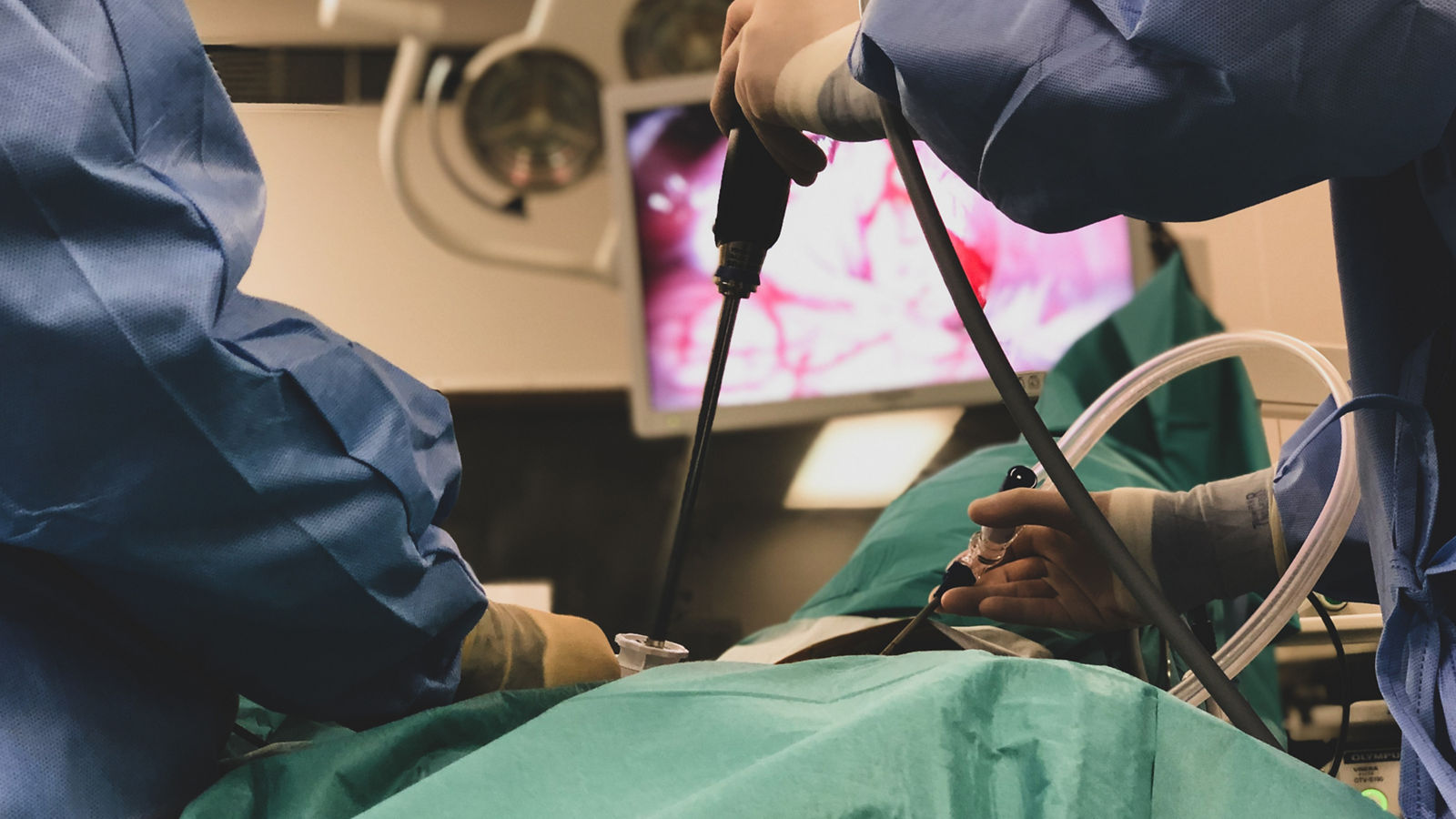 Surgeons using surgical instruments for keyhole surgery, watching the monitor which displays images from inside the patient's abdomen - operating theatre with lights in the background. 