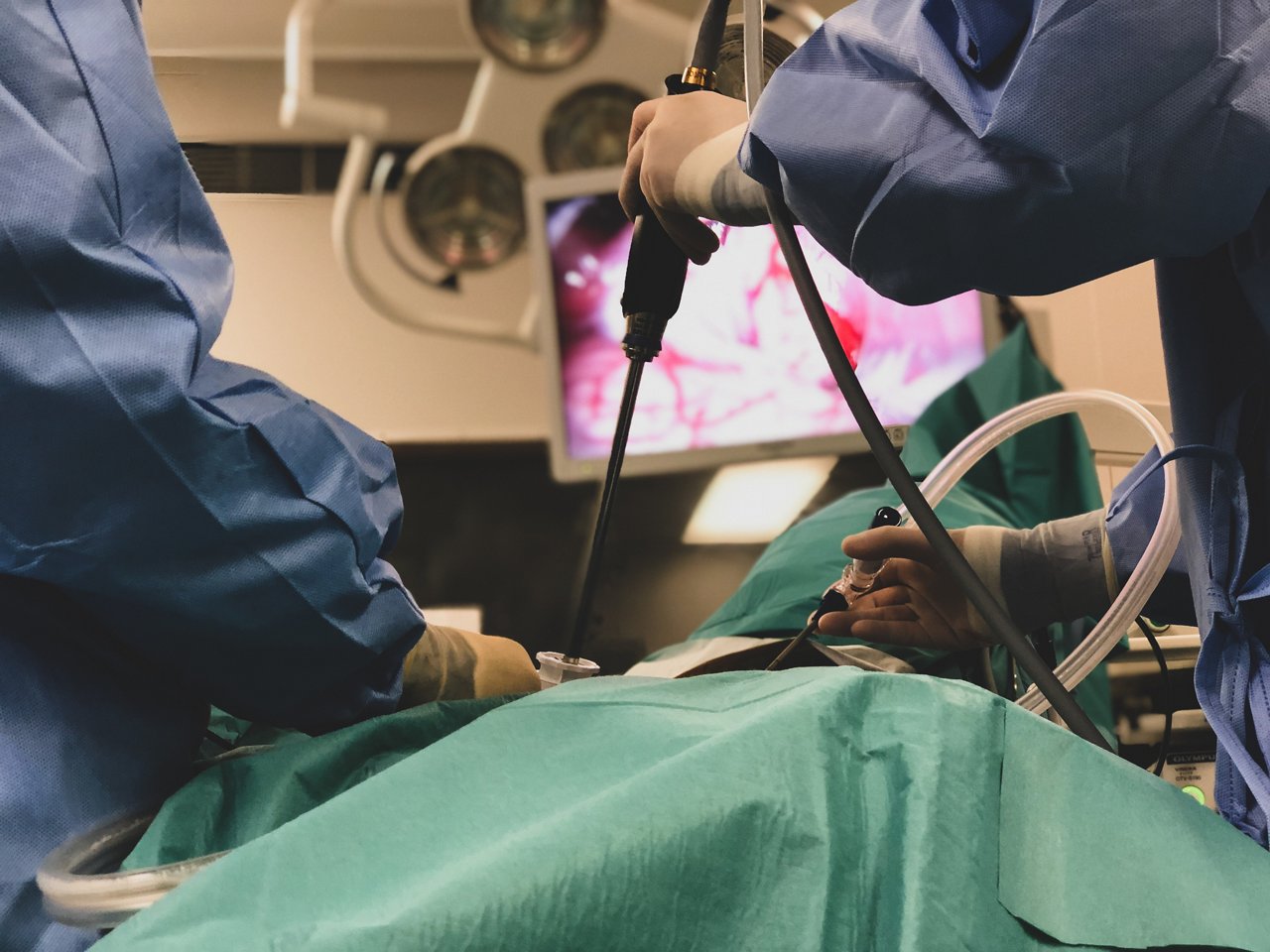 Operateure stehen am OP-Tisch mit OP-Kleidung und operieren minimal-invasiv im Bauchraum