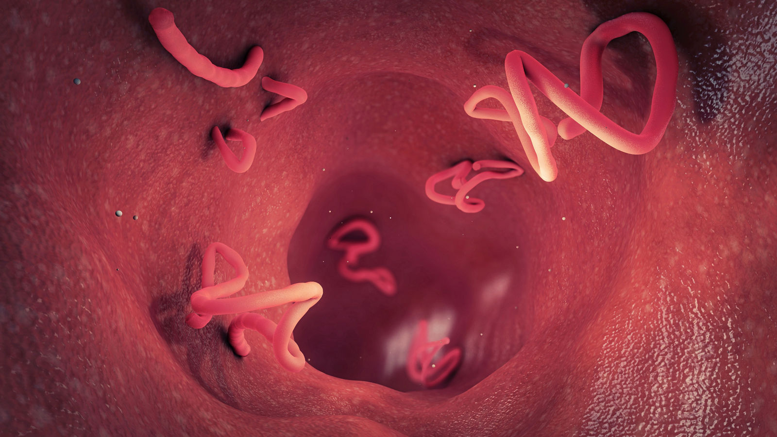 Tapeworm infestation in a human intestine - 3d illustration