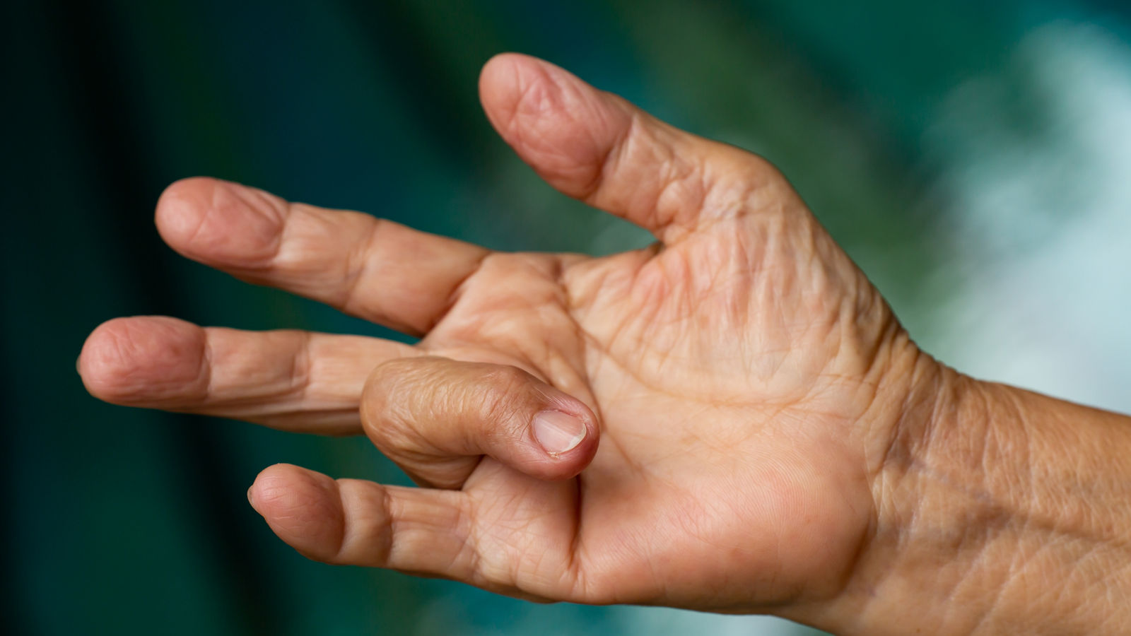 Trigger Finger lock on ring finger of senior woman's right hand, Suffering from pain, Swimming pool background, Health care concept