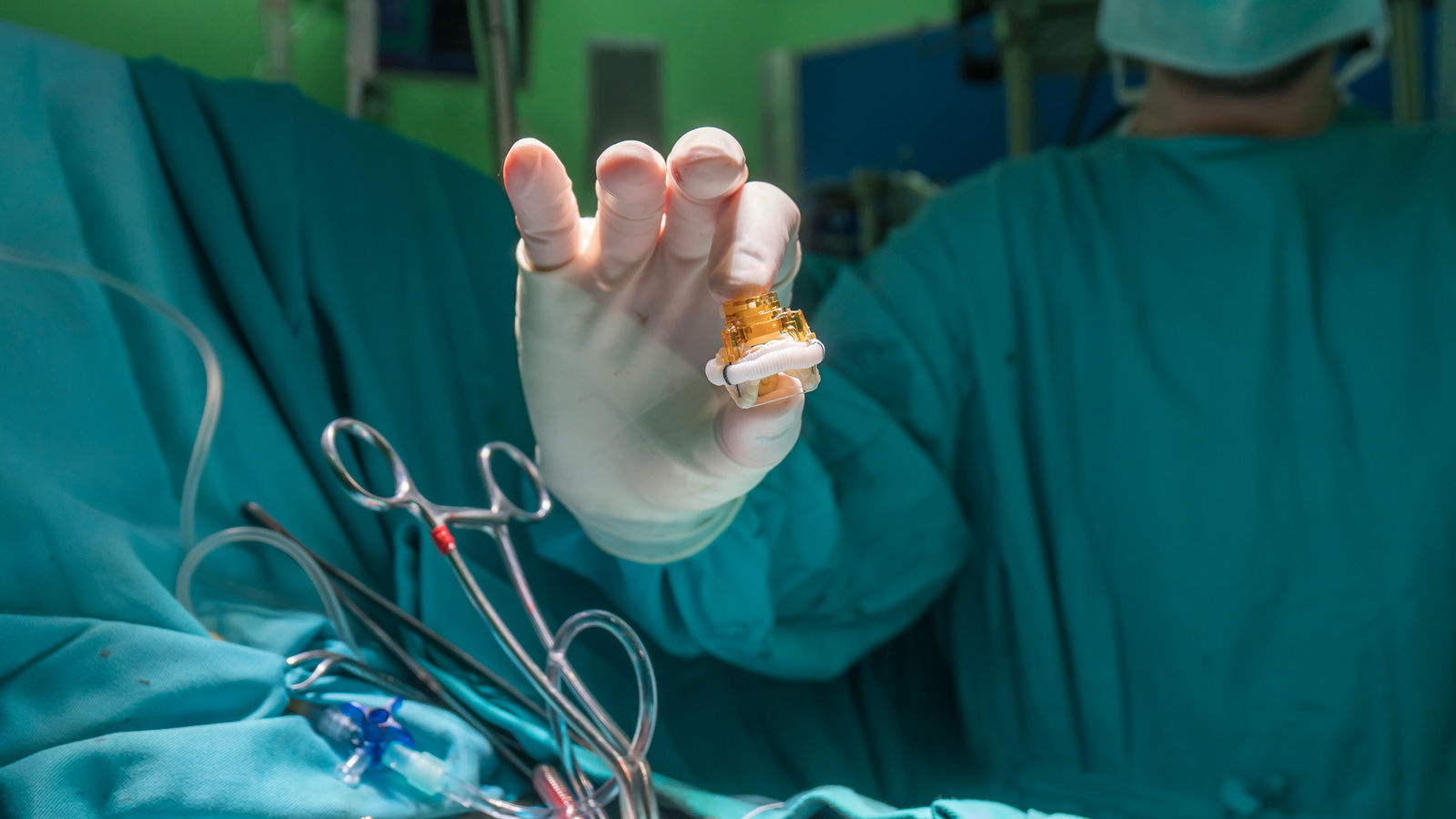 Heart valve prosthesis. Image of surgeon hand holding aortic valve implant in the operating room,Heart valve prosthesis. Image of surgeon hand holding aortic val