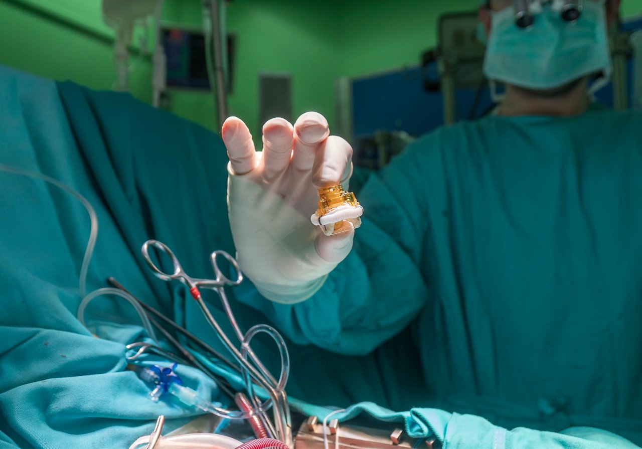 Heart valve prosthesis. Image of surgeon hand holding aortic valve implant in the operating room 