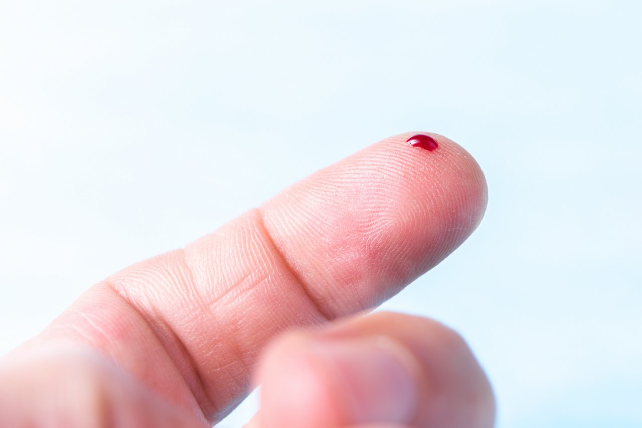 Zeigefinger in Nahaufnahme mit kleinem Bluttropfen